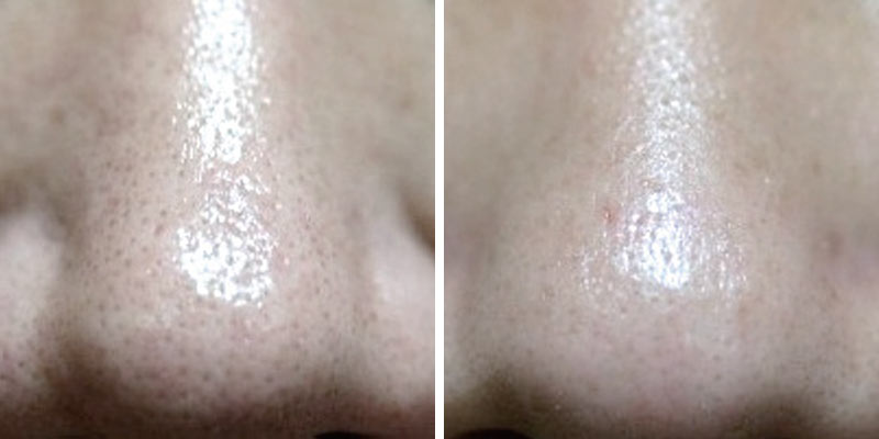 before-after-03