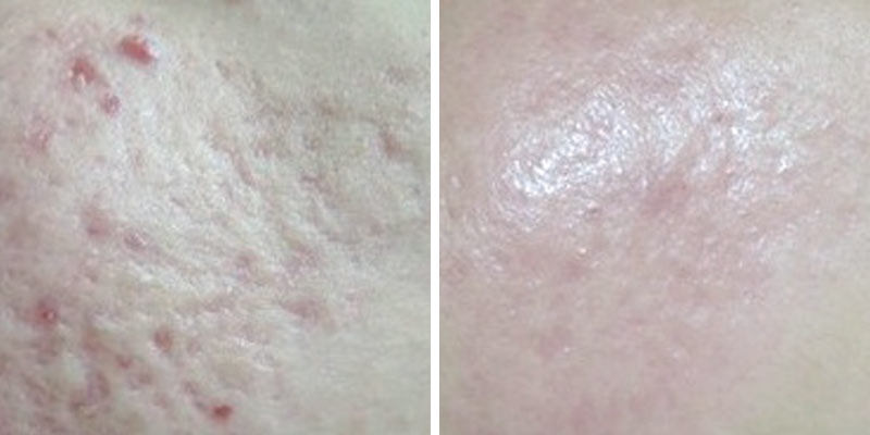 before-after-03